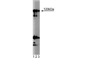Western blot analysis of NFAT-1 on a Jurkat cell lysate (Human T-cell leukemia, ATCC TIB-152). (NFAT1 Antikörper  (AA 29-181))