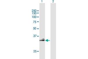 Western Blot analysis of HAS3 expression in transfected 293T cell line by HAS3 MaxPab polyclonal antibody. (HAS3 Antikörper  (AA 1-281))