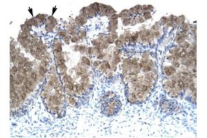 ASGR2 antibody was used for immunohistochemistry at a concentration of 4-8 ug/ml to stain Epithelial cells of intestinal villus (arrows) in Human Intestine. (Asialoglycoprotein Receptor 2 Antikörper  (N-Term))