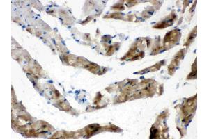 Immunohistochemistry (IHC) image for anti-Fatty Acid Binding Protein 3, Muscle and Heart (FABP3) (AA 119-133), (C-Term) antibody (ABIN3042627)