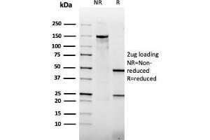 SDS-PAGE Analysis Purified Thrombomodulin Mouse Recombinant Monoclonal Antibody (rTHBD/1591). (Rekombinanter Thrombomodulin Antikörper  (AA 69-194))