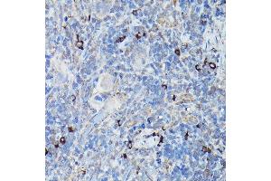 Immunohistochemistry of paraffin-embedded rat spleen using DDIT3/CHOP Rabbit pAb (ABIN6131562, ABIN6139460, ABIN6139463 and ABIN6215170) at dilution of 1:200 (40x lens). (DDIT3 Antikörper  (AA 1-169))