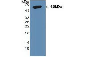 Detection of Recombinant SORT1, Human using Polyclonal Antibody to Sortilin 1 (SORT1) (Sortilin 1 Antikörper  (AA 50-320))