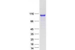 Validation with Western Blot (CYLD Protein (Transcript Variant 2) (Myc-DYKDDDDK Tag))