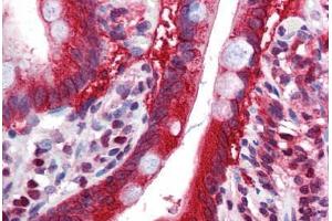 Human Small Intestine: Formalin-Fixed, Paraffin-Embedded (FFPE) (FTO Antikörper  (N-Term))