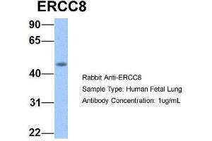 Host:  Rabbit  Target Name:  ERCC8  Sample Type:  Human Fetal Lung  Antibody Dilution:  1. (ERCC8 Antikörper  (C-Term))