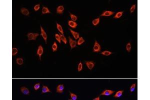 Immunofluorescence analysis of L929 cells using NRP1 Polyclonal Antibody at dilution of 1:100. (Neuropilin 1 Antikörper)