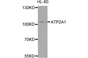 Western blot analysis of extracts of HL-60 cells, using ATP2A1 antibody (ABIN4902981) at 1:1000 dilution. (ATP2A1/SERCA1 Antikörper)