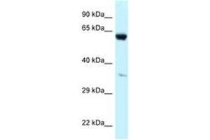 Image no. 1 for anti-Prolyl 4-Hydroxylase, alpha Polypeptide I (P4HA1) (AA 228-277) antibody (ABIN6747682) (P4HA1 Antikörper  (AA 228-277))