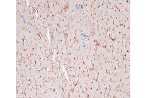 Immunohistochemistry of paraffin-embedded Mouse heart using CD36 Polyclonal Antibody at dilution of 1:200 (40x lens). (CD36 Antikörper)