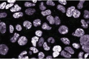 Immunofluoresence staining on 293 cells. (DEK Antikörper  (AA 19-169))