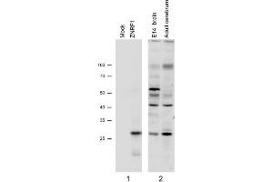 N2a overexpressing Mouse Znrf1 (mock transfection in first lane) and probed with ZNRF1 Antibody   (1µg/ml), also staining of Mouse Brain lysates (Embryo E14 and adult cerebellum). (ZNRF1 Antikörper)