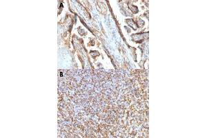 Immunohistochemical staining (Formalin-fixed paraffin-embedded sections) of human placenta (A) and human spleen (B) with LGALS13 monoclonal antibody, clone PP13/1161 .