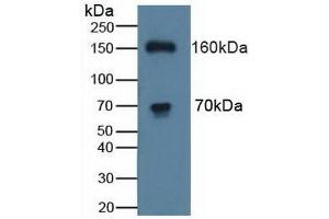 Detection of ATP7b in Human K562 Cells using Polyclonal Antibody to ATPase, Cu++ Transporting Beta Polypeptide (ATP7b) (ATP7B Antikörper  (AA 59-426))