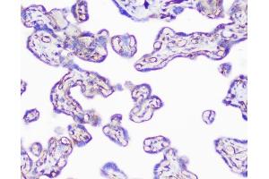 IHC analysis of INPPL1 using anti-INPPL1 antibody (ABIN6719492).