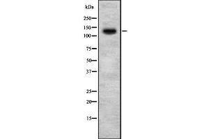 Western blot analysis of HIPK2 using 293 whole  lysates. (HIPK2 Antikörper  (N-Term))