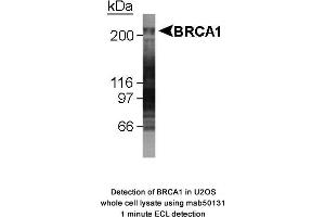 Image no. 1 for anti-Breast Cancer 1 (BRCA1) (AA 1314-1600), (AA 1314-1864) antibody (ABIN363285) (BRCA1 Antikörper  (AA 1314-1600, AA 1314-1864))