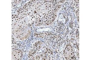 IHC analysis of MBNL1 using anti-MBNL1 antibody (ABIN7602608). (MBNL1 Antikörper  (AA 89-388))