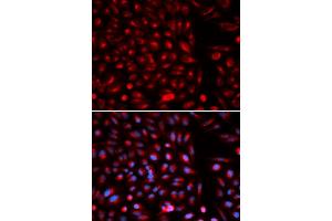 Immunofluorescence (IF) image for anti-Axin 2 (AXIN2) antibody (ABIN1875444)
