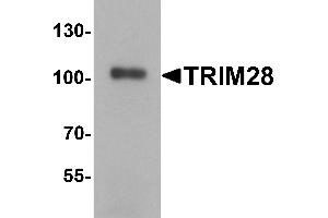 Western Blotting (WB) image for anti-Tripartite Motif Containing 28 (TRIM28) (C-Term) antibody (ABIN1077358) (KAP1 Antikörper  (C-Term))