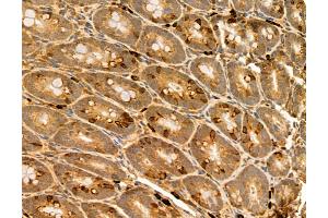 ABIN6265587 and ABIN6272983 at 1/100 staining Rat colon tissue by IHC-P.