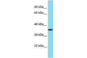 Host: Rabbit Target Name: SIAH3 Sample Type: MCF7 Whole Cell lysates Antibody Dilution: 1. (SIAH3 Antikörper  (C-Term))