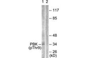 Western blot analysis of extracts from K562 cells treated with UV 30', using PBK/TOPK (Phospho-Thr9) Antibody. (PBK Antikörper  (pThr9))