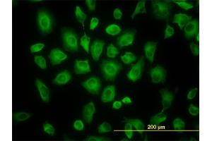 Immunofluorescence of monoclonal antibody to TUBB4B on HeLa cell. (TUBB2C Antikörper  (AA 1-445))