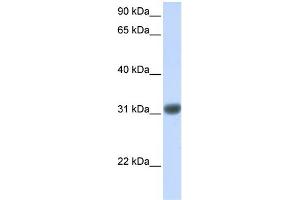WB Suggested Anti-OTX2 Antibody Titration: 0. (OTX2 Antikörper  (Middle Region))