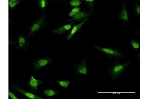 Immunofluorescence of purified MaxPab antibody to MPHOSPH8 on HeLa cell. (MPHOSPH8 Antikörper  (AA 1-259))