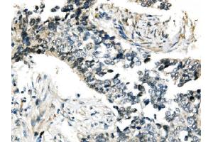 IHC analysis of RNF168 using anti-RNF168 antibody (ABIN7601889).