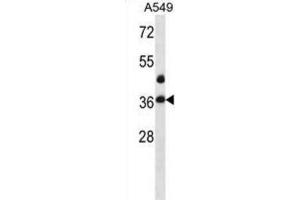 Western Blotting (WB) image for anti-LIM and SH3 Protein 1 (LASP1) antibody (ABIN2998401) (LASP1 Antikörper)