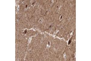Immunohistochemical staining of human cerebral cortex with ACOT4 polyclonal antibody  shows strong cytoplasmic and nuclear positivity in neuronal cells. (ACOT4 Antikörper)