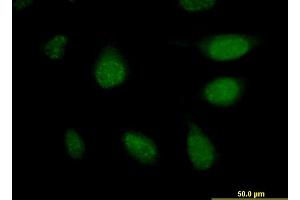 Immunofluorescence of monoclonal antibody to APCS on HeLa cell. (APCS Antikörper  (AA 35-149))