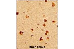 Formalin-fixed and paraffin-embedded human brain with KHSRP Antibody (N-term), which was peroxidase-conjugated to the secondary antibody, followed by DAB staining. (KHSRP Antikörper  (N-Term))