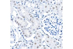 Immunohistochemistry (IHC) image for anti-BMI1 Polycomb Ring Finger Oncogene (BMI1) (AA 250-300) antibody (ABIN7455106) (Rekombinanter BMI1 Antikörper  (AA 250-300))