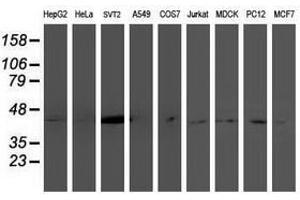 Image no. 2 for anti-NudE Nuclear Distribution E Homolog (A. Nidulans)-Like 1 (NDEL1) antibody (ABIN1499855) (NDEL1 Antikörper)