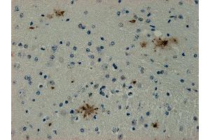 Immunostaining of paraffin embedded sections from mouse brain area containing Alzheimer plaques (dilution 1 : 1000).