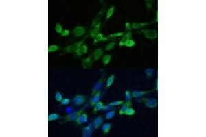 Immunofluorescence analysis of NIH-3T3 cells using SQS/FDFT1 antibody (ABIN6130393, ABIN6140567, ABIN6140568 and ABIN6221824) at dilution of 1:100. (FDFT1 Antikörper  (AA 1-260))