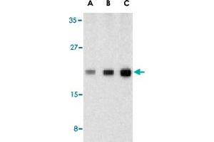 Western blot analysis of CASP1 in human heart tissue lysate with CASP1 polyclonal antibody  at (A) 0.