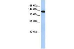 Image no. 1 for anti-Myosin Binding Protein C, Fast Type (MYBPC2) (AA 36-85) antibody (ABIN6740750) (MYBPC2 Antikörper  (AA 36-85))