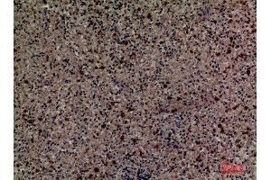 Immunohistochemistry (IHC) analysis of paraffin-embedded Human Spleen, antibody was diluted at 1:100.