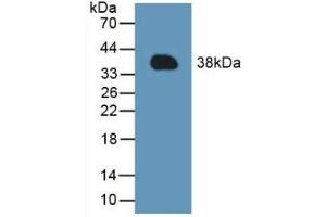 Detection of Recombinant MCL1, Mouse using Polyclonal Antibody to Induced Myeloid Leukemia Cell Differentiation Protein Mcl-1 (MCL1) (MCL-1 Antikörper  (AA 2-307))