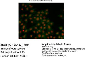 Image no. 2 for anti-Zinc Finger E-Box Binding Homeobox 1 (ZEB1) (N-Term) antibody (ABIN2779631) (ZEB1 Antikörper  (N-Term))