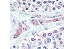 Immunohistochemistry (IHC) image for anti-Lin-28 Homolog B (LIN28B) (AA 1-30) antibody (ABIN3031628)