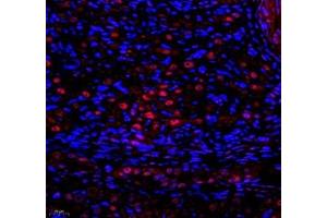 Immunofluorescence of paraffin embedded rat ovary using SNRNP200 (ABIN7075632) at dilution of 1: 650 (400x lens) (SNRNP200 Antikörper)