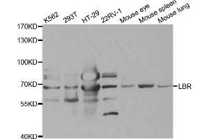 Western Blotting (WB) image for anti-Lamin B Receptor (LBR) antibody (ABIN1876656) (Lamin B Receptor Antikörper)