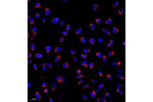 Immunocytochemistry of paraffin embedded human HeLa cells using TOMO20 (ABIN7074636) at dilution of 1:1000 (200x lens) (TOMM20 Antikörper)
