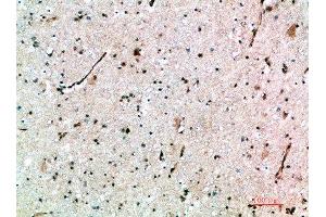 Immunohistochemical analysis of paraffin-embedded human-brain, antibody was diluted at 1:200 (AVPR1B Antikörper  (AA 271-320))