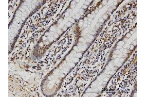 Image no. 1 for anti-Family with Sequence Similarity 3, Member B (FAM3B) (AA 1-236) antibody (ABIN599570) (FAM3B Antikörper  (AA 1-236))